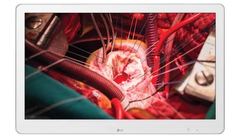 LG Full HD Cerrahi Monitör