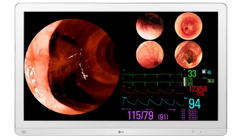 LG 31,5″ 4K IPS Cerrahi Monitör